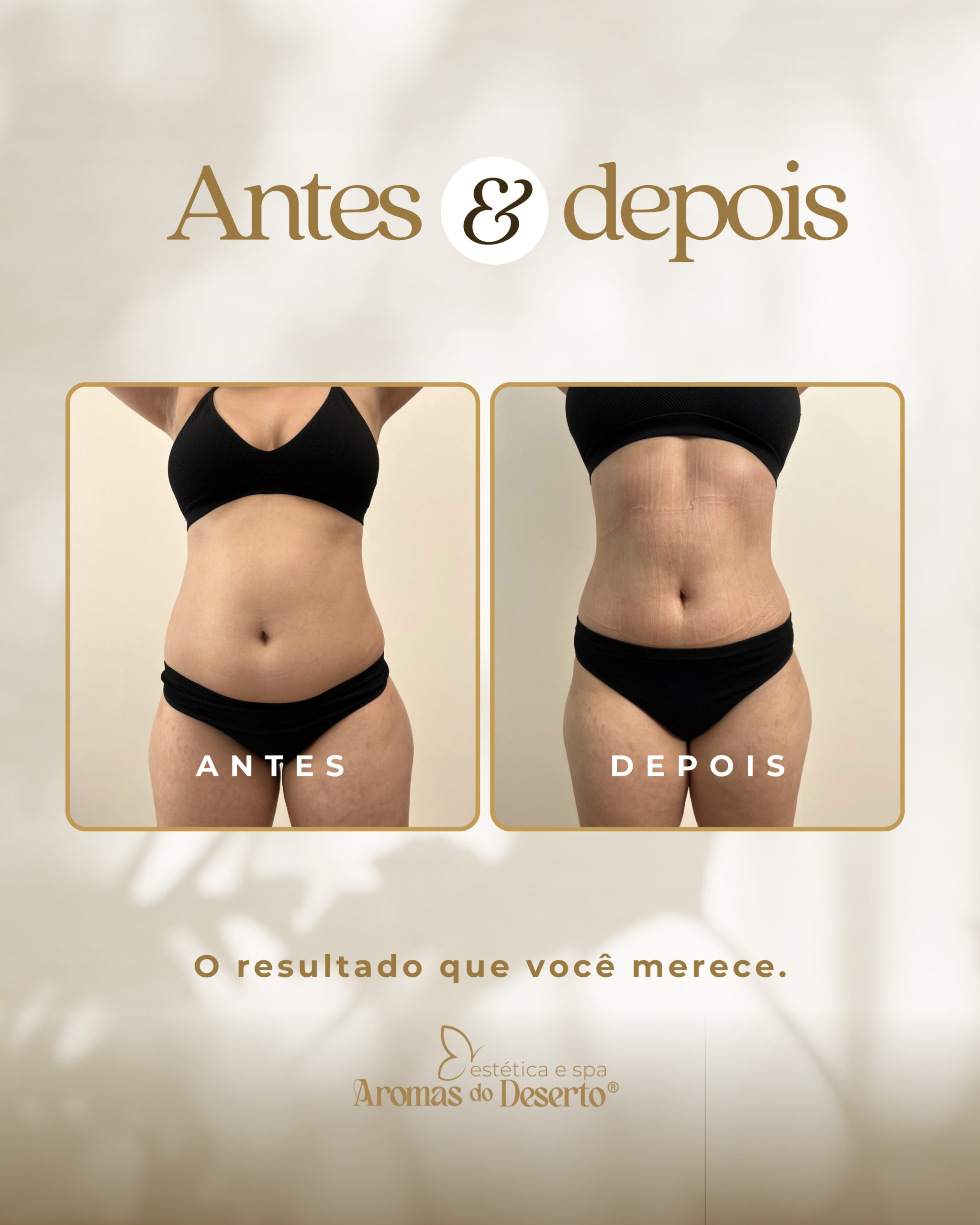 Antes e Depois - Resultado 1