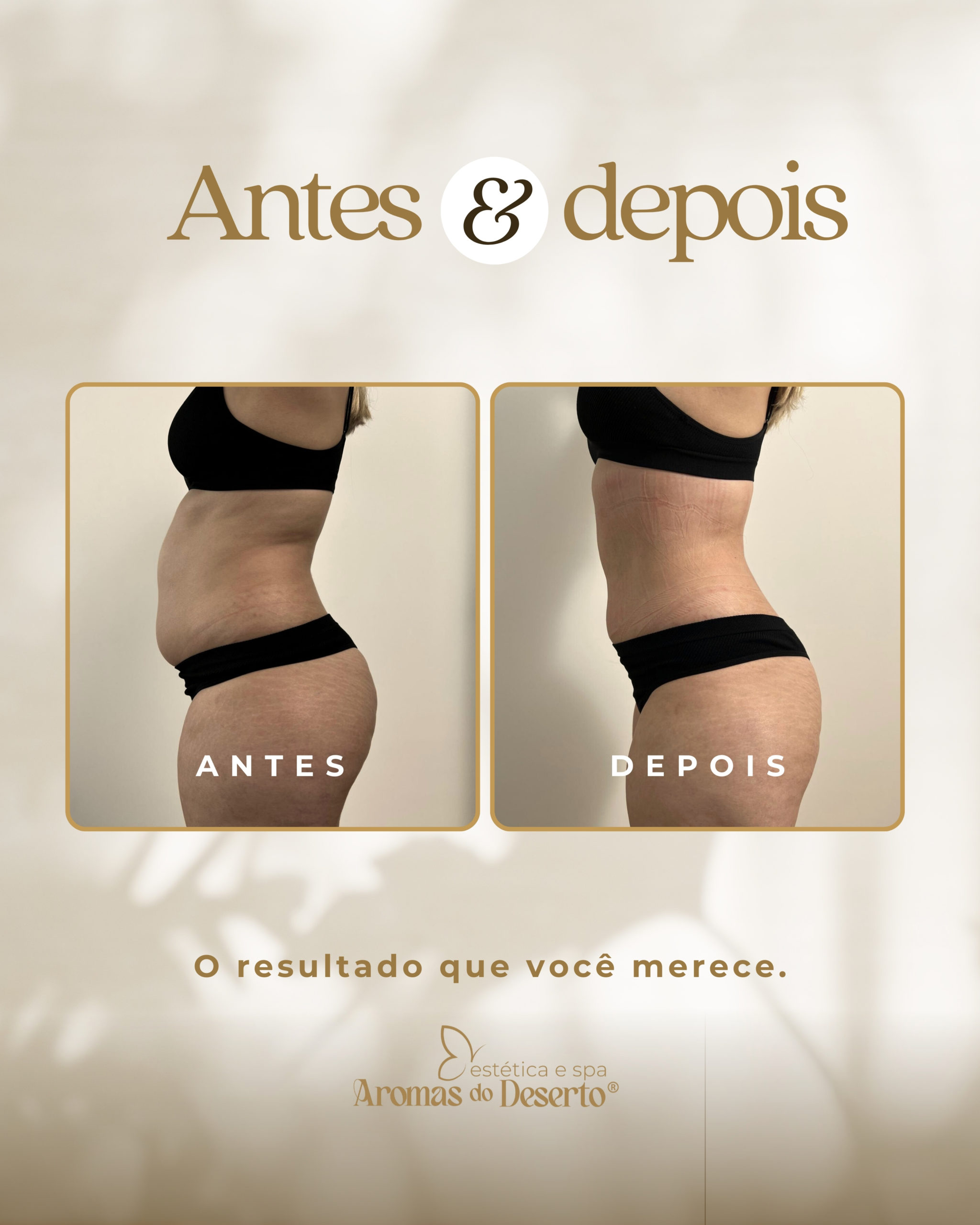 Antes e Depois - Resultado 2