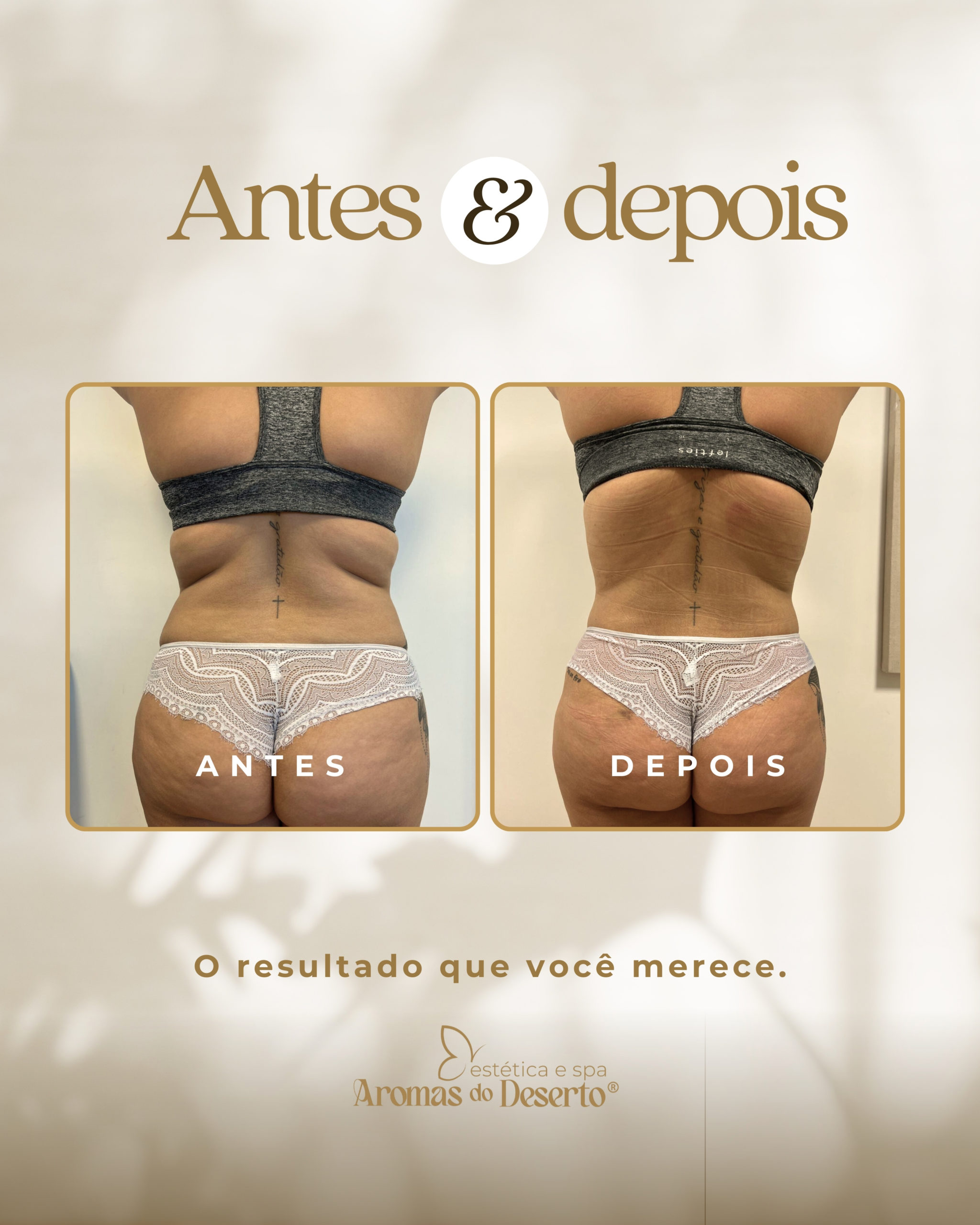 Antes e Depois - Resultado 3