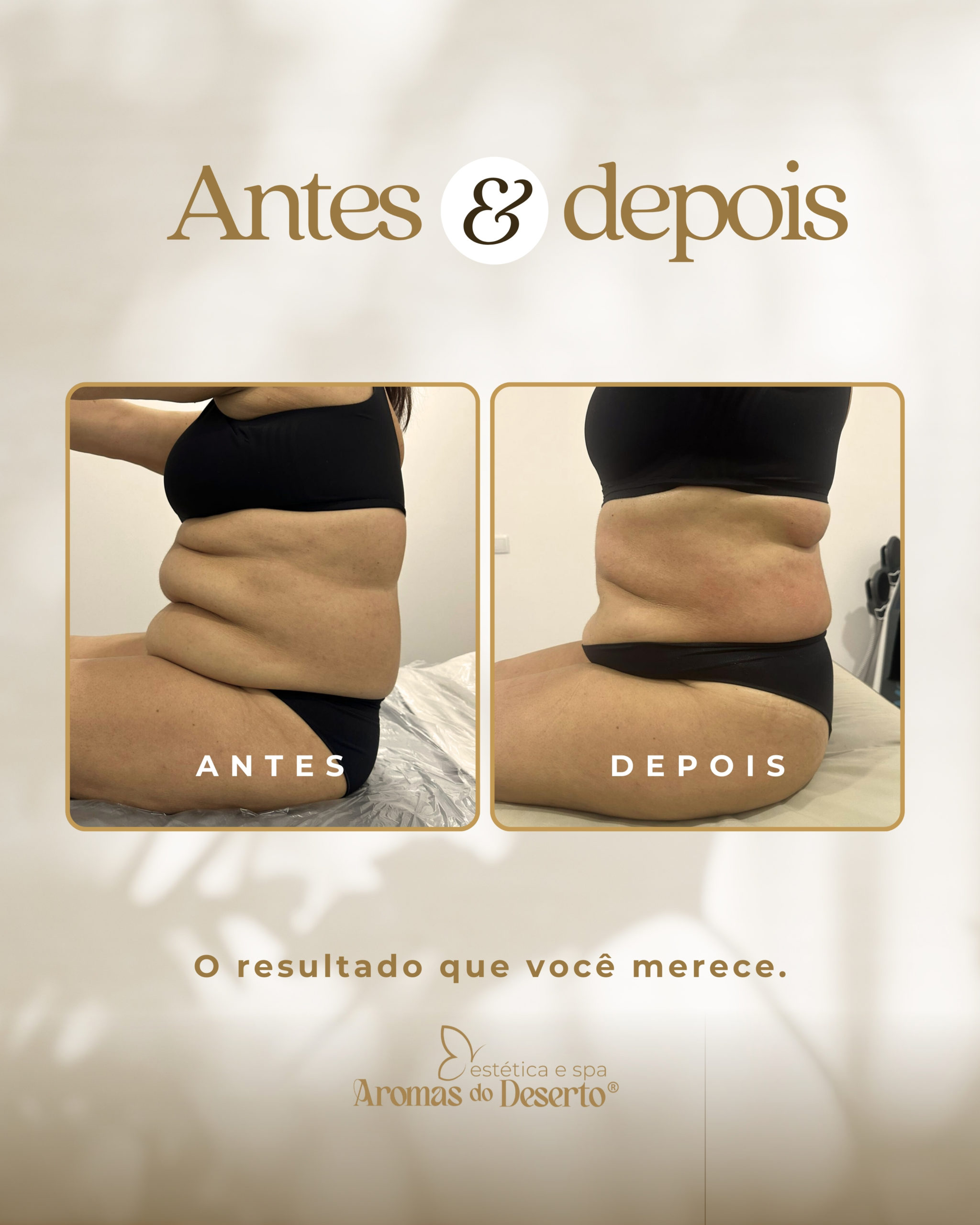 Antes e Depois - Resultado 4