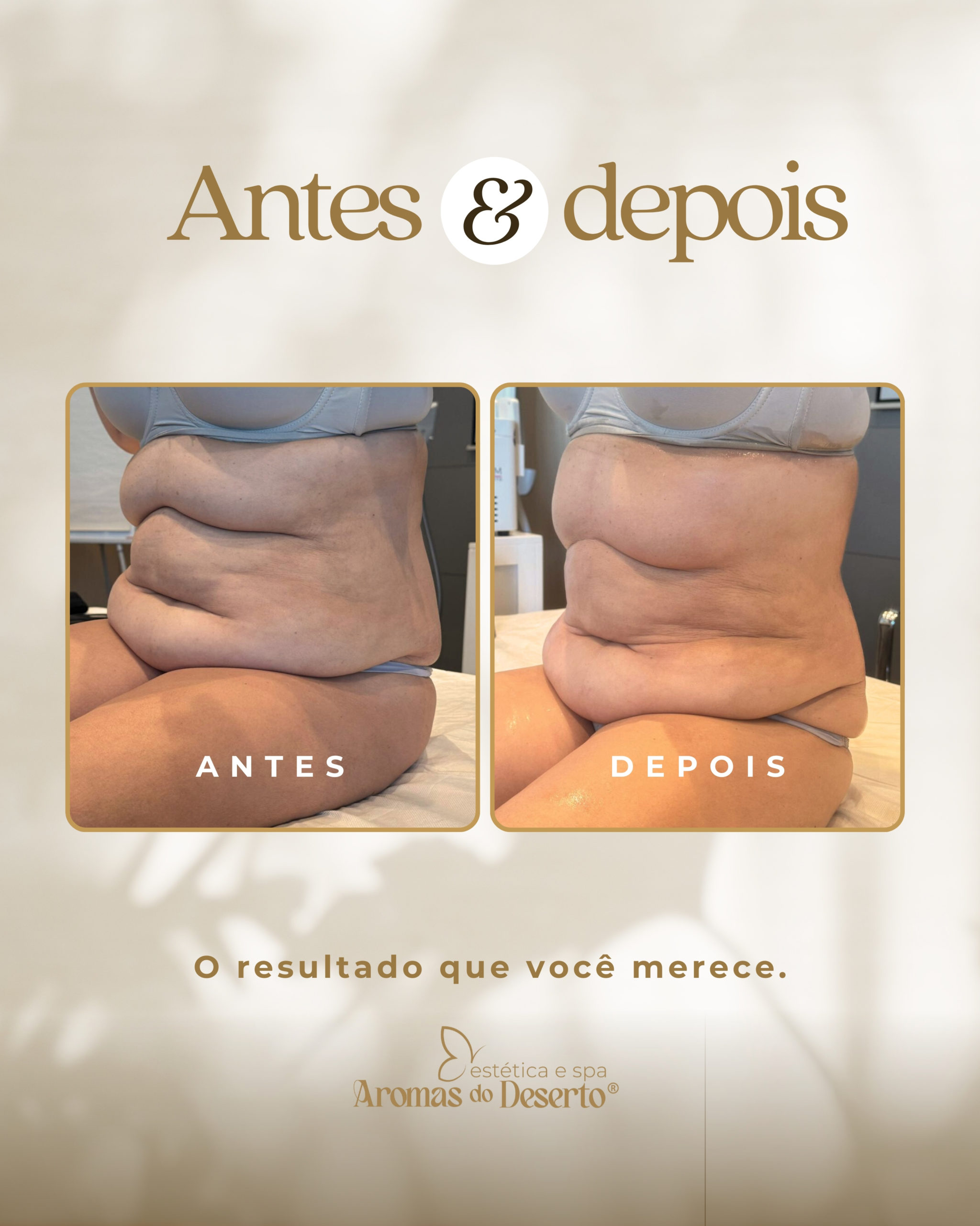 Antes e Depois - Resultado 5