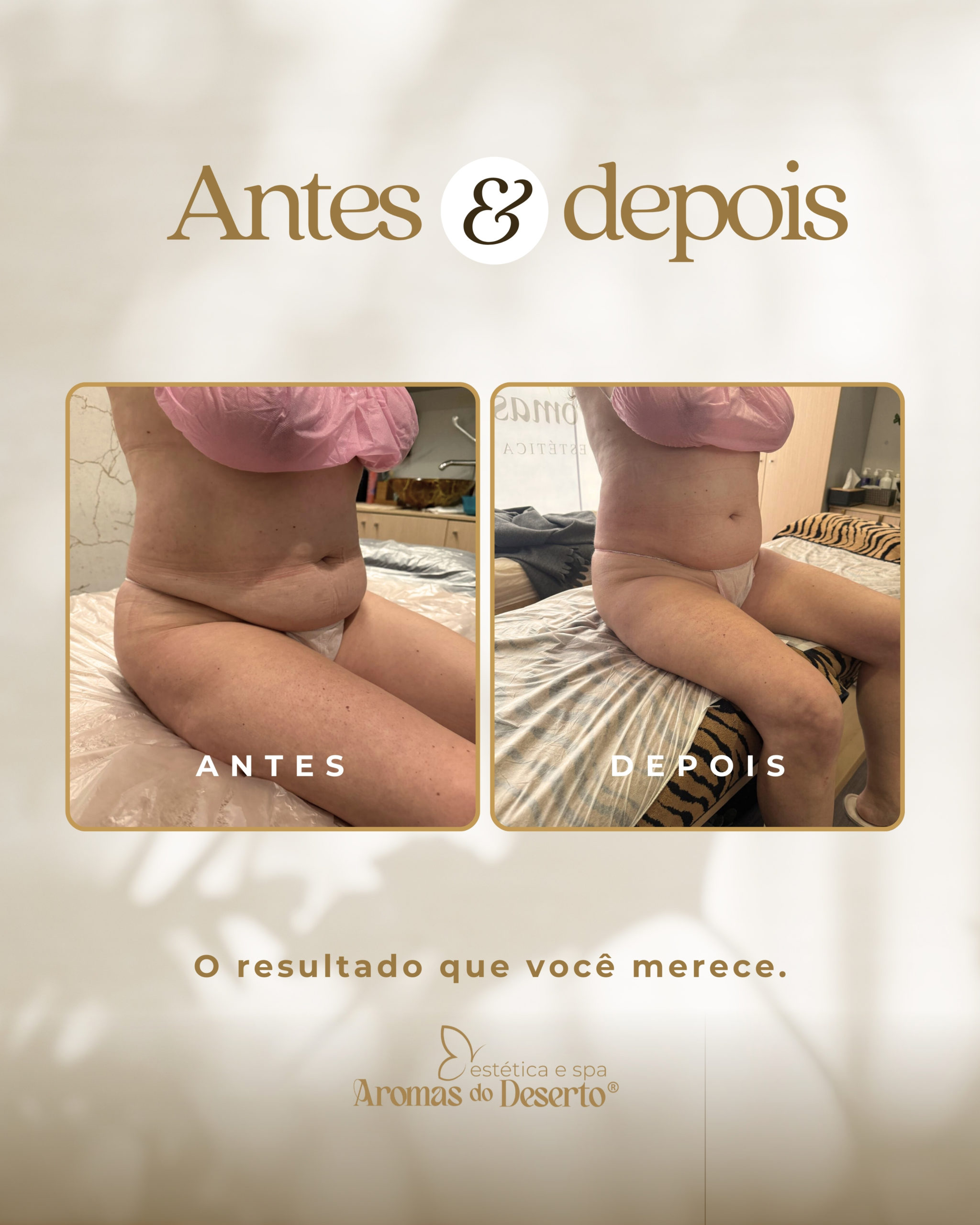 Antes e Depois - Resultado 6