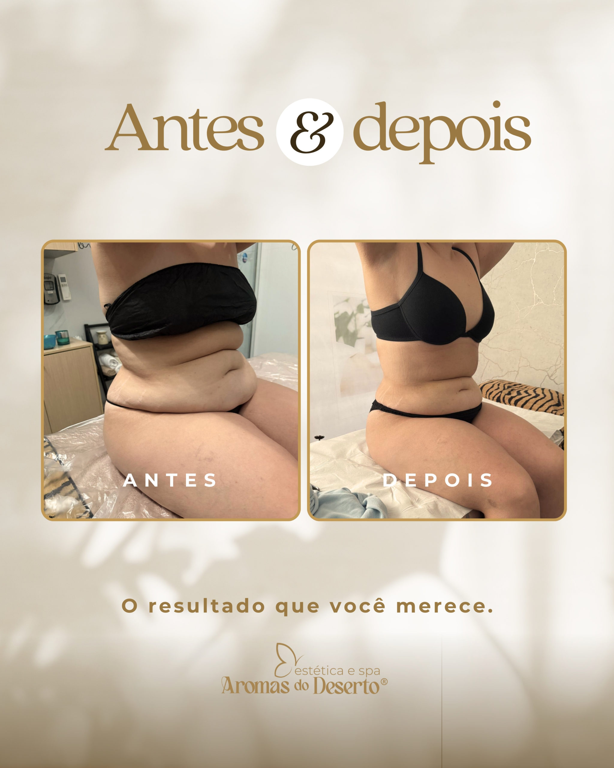 Antes e Depois - Resultado 7