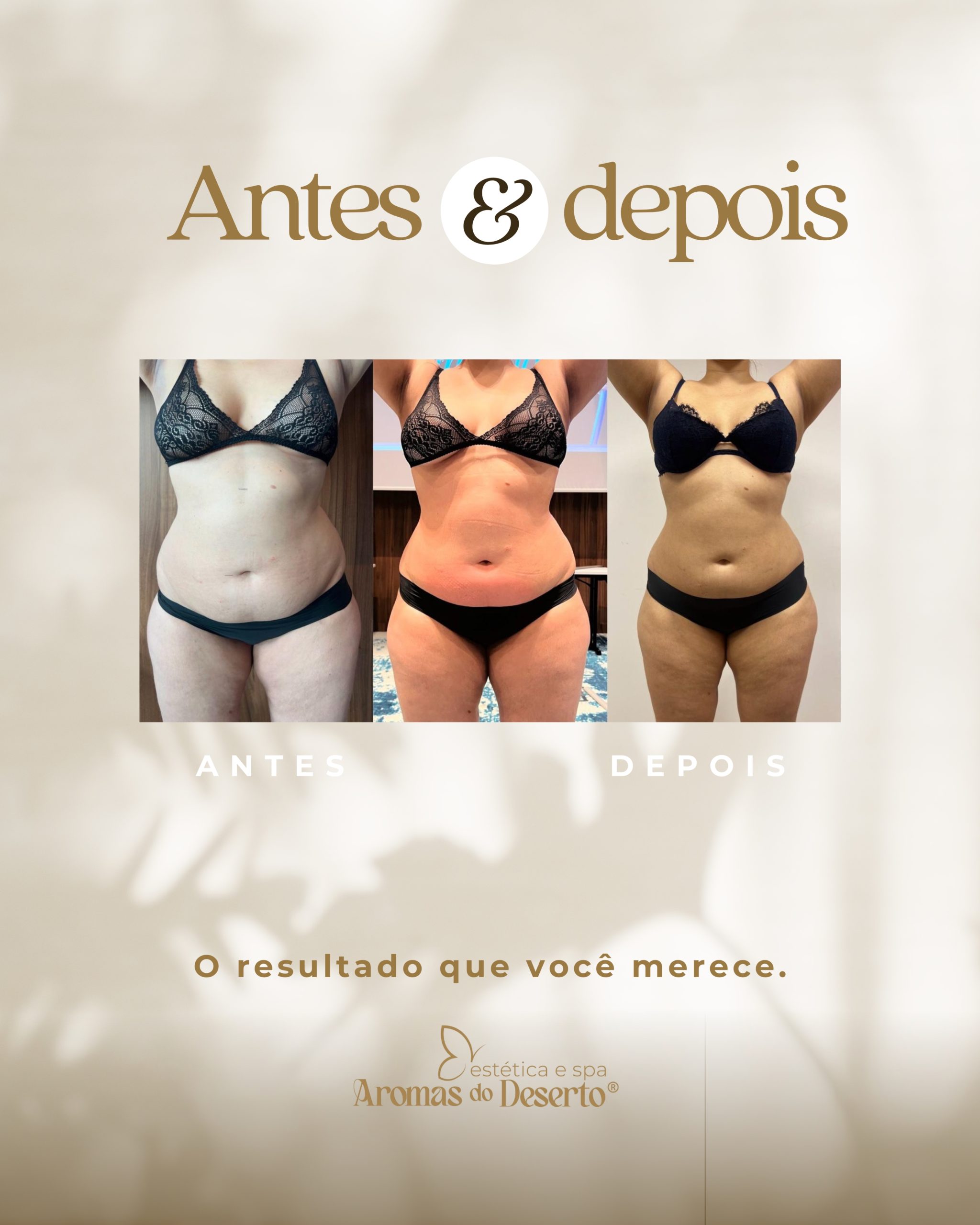 Antes e Depois - Resultado 8