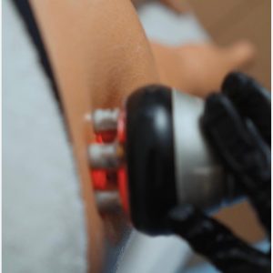 Body Sculpt RF — Radiofrequência Corporal