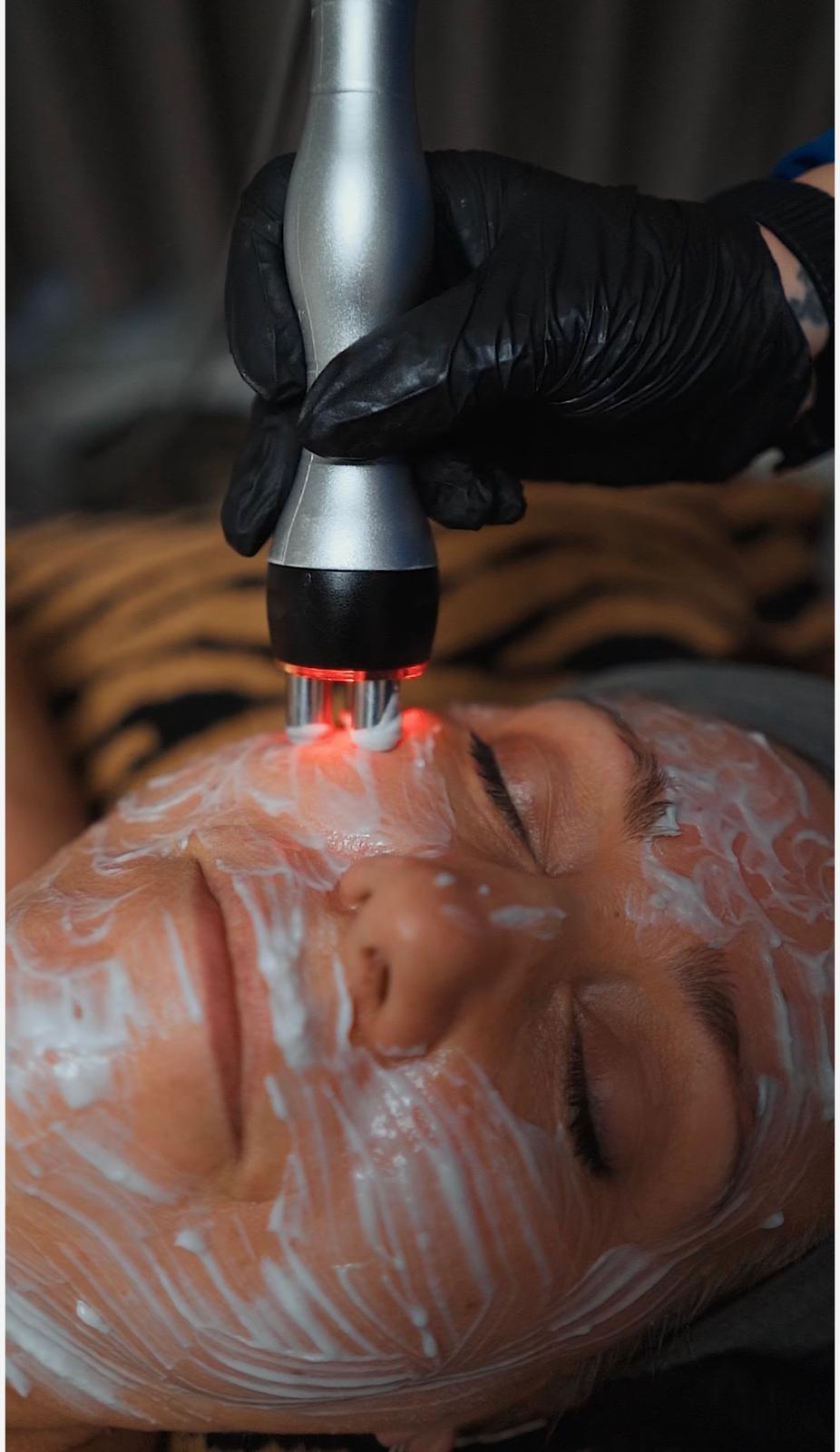 Lifting RF Glow — Radiofrequência Facial